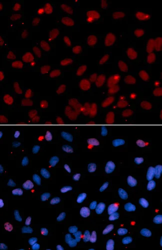Immunocytochemistry/ Immunofluorescence - Anti-SF2 antibody (AB238523)