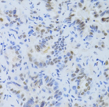Immunohistochemistry (Formalin/PFA-fixed paraffin-embedded sections) - Anti-SF2 antibody (AB238523), expandable thumbnail