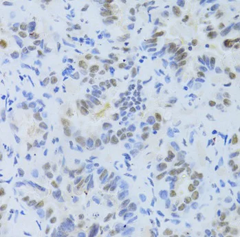 Immunohistochemistry (Formalin/PFA-fixed paraffin-embedded sections) - Anti-SF2 antibody (AB238523)