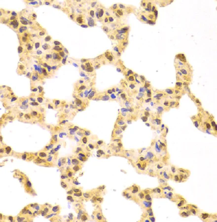 Immunohistochemistry (Formalin/PFA-fixed paraffin-embedded sections) - Anti-SF2 antibody (AB238523)