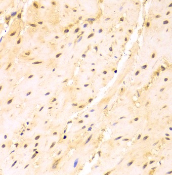 Immunohistochemistry (Formalin/PFA-fixed paraffin-embedded sections) - Anti-SF2 antibody (AB238523), expandable thumbnail