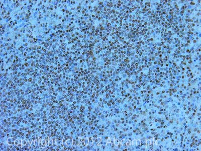 Immunohistochemistry (Formalin/PFA-fixed paraffin-embedded sections) - Anti-SF2 antibody (AB38017)
