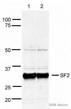 Western blot - Anti-SF2 antibody (AB38017)