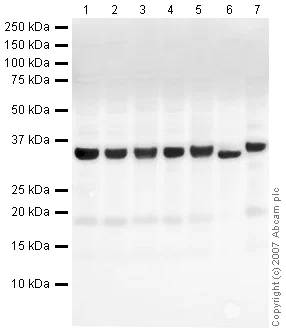 Western blot - Anti-SF2 antibody (AB38017)
