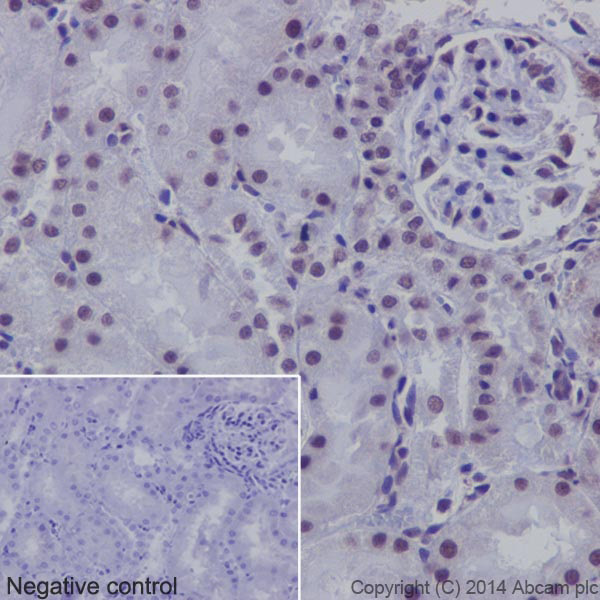Immunohistochemistry (Formalin/PFA-fixed paraffin-embedded sections) - Anti-SF2 antibody [EPR8239] (AB129108), expandable thumbnail