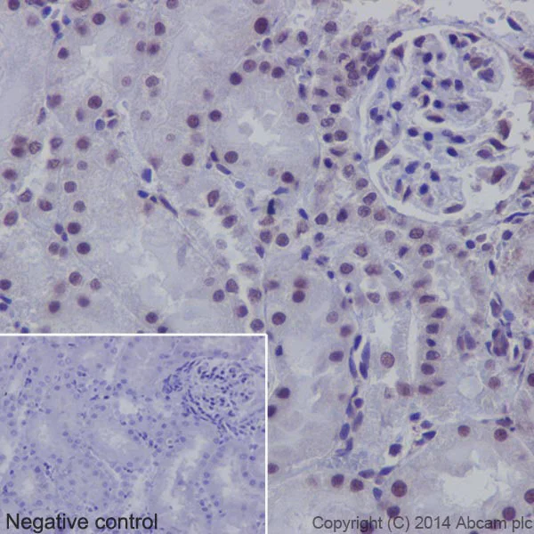 Immunohistochemistry (Formalin/PFA-fixed paraffin-embedded sections) - Anti-SF2 antibody [EPR8239] (AB129108)