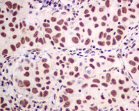 Immunohistochemistry (Formalin/PFA-fixed paraffin-embedded sections) - Anti-SF2 antibody [EPR8239] (ab129108), expandable thumbnail