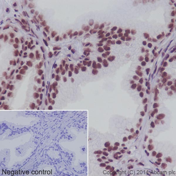 Immunohistochemistry (Formalin/PFA-fixed paraffin-embedded sections) - Anti-SF2 antibody [EPR8239] (AB129108), expandable thumbnail