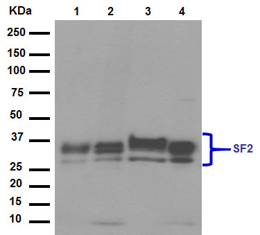 Western blot - Anti-SF2 antibody [EPR8239] (ab129108), expandable thumbnail