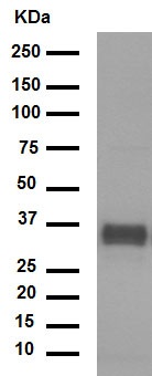 Western blot - Anti-SF2 antibody [EPR8239] (AB129108), expandable thumbnail