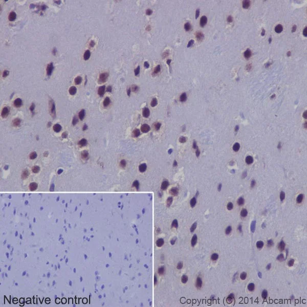 Immunohistochemistry (Formalin/PFA-fixed paraffin-embedded sections) - Anti-SF2 antibody [EPR8239] - BSA and Azide free (AB248306)