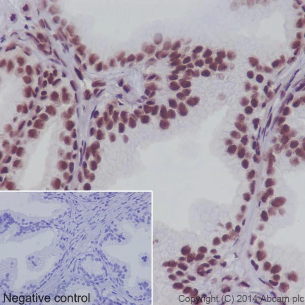 Immunohistochemistry (Formalin/PFA-fixed paraffin-embedded sections) - Anti-SF2 antibody [EPR8239] - BSA and Azide free (AB248306)