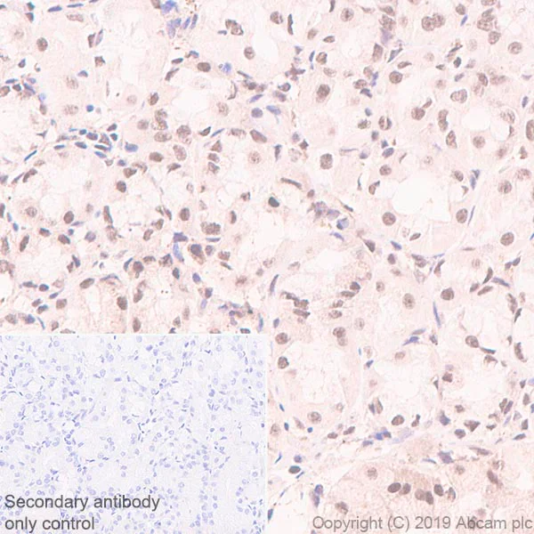 Immunohistochemistry (Formalin/PFA-fixed paraffin-embedded sections) - Anti-SF2 antibody [EPR8240] (AB133689)