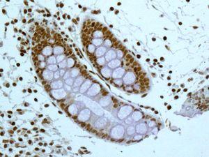 Immunohistochemistry (Formalin/PFA-fixed paraffin-embedded sections) - Anti-SF2 antibody [EPR8240] (AB133689)