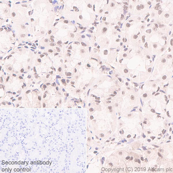 Immunohistochemistry (Formalin/PFA-fixed paraffin-embedded sections) - Anti-SF2 antibody [EPR8240] - BSA and Azide free (AB248619), expandable thumbnail