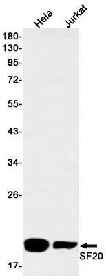 Western blot - Anti-SF20 Antibody [S06-7B1] (AB317416), expandable thumbnail