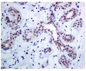 Immunohistochemistry (Formalin/PFA-fixed paraffin-embedded sections) - Anti-SF3A1 antibody [EPR7666] (AB128868)