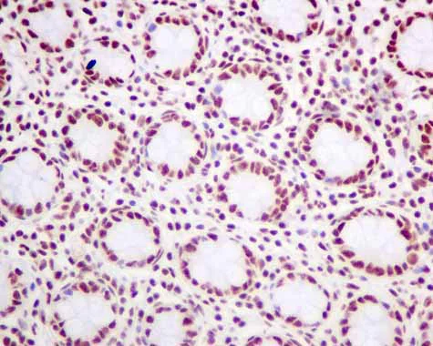 Immunohistochemistry (Formalin/PFA-fixed paraffin-embedded sections) - Anti-SF3A3 antibody [EPR10020] (AB156873)