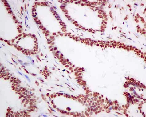 Immunohistochemistry (Formalin/PFA-fixed paraffin-embedded sections) - Anti-SF3A3 antibody [EPR10020] (AB156873)
