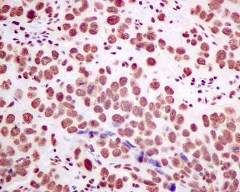 Immunohistochemistry (Formalin/PFA-fixed paraffin-embedded sections) - Anti-SF3A3 antibody [EPR10020] (AB156873)