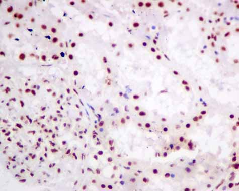 Immunohistochemistry (Formalin/PFA-fixed paraffin-embedded sections) - Anti-SF3A3 antibody [EPR10020] (AB156873)