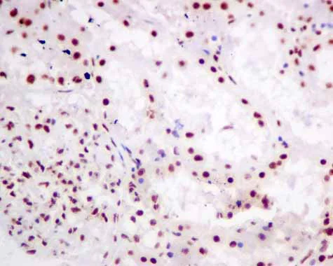 Immunohistochemistry (Formalin/PFA-fixed paraffin-embedded sections) - Anti-SF3A3 antibody [EPR10020] (AB156873)