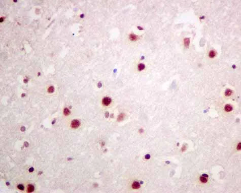 Immunohistochemistry (Formalin/PFA-fixed paraffin-embedded sections) - Anti-SF3A3 antibody [EPR10020] (AB156873)
