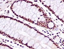 Immunohistochemistry (Formalin/PFA-fixed paraffin-embedded sections) - Anti-SF3B1 antibody [EPR11986] (AB172634)