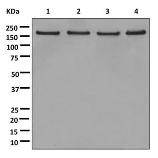 Western blot - Anti-SF3B1 antibody [EPR11986] (AB172634)