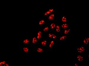 Immunocytochemistry/ Immunofluorescence - Anti-SF3B1 antibody [EPR11986] - BSA and Azide free (AB240170)