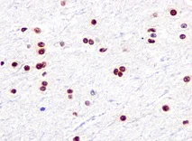 Immunohistochemistry (Formalin/PFA-fixed paraffin-embedded sections) - Anti-SF3B1 antibody [EPR11986] - BSA and Azide free (AB240170)