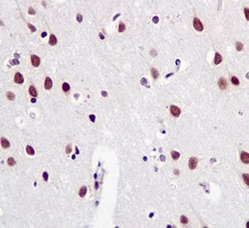 Immunohistochemistry (Formalin/PFA-fixed paraffin-embedded sections) - Anti-SF3B1 antibody [EPR11987(B)] (AB170854), expandable thumbnail