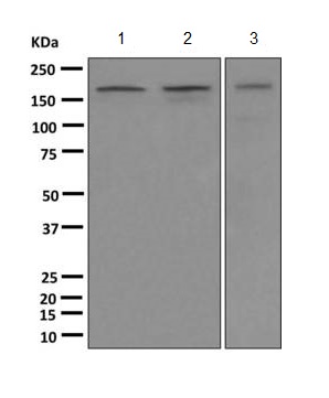 Western blot - Anti-SF3B1 antibody [EPR11987(B)] (AB170854), expandable thumbnail