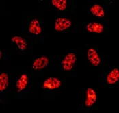 Immunocytochemistry/ Immunofluorescence - Anti-SF3B1 antibody [EPR11987(B)] - BSA and Azide free (AB249538)