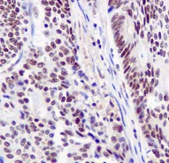 Immunohistochemistry (Formalin/PFA-fixed paraffin-embedded sections) - Anti-SF3B1 antibody [EPR11987(B)] - BSA and Azide free (AB249538)