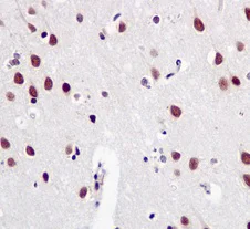 Immunohistochemistry (Formalin/PFA-fixed paraffin-embedded sections) - Anti-SF3B1 antibody [EPR11987(B)] - BSA and Azide free (AB249538)