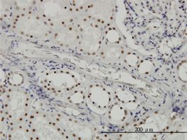 Immunohistochemistry (Formalin/PFA-fixed paraffin-embedded sections) - Anti-SF3B2 antibody [5D2] (AB56800)