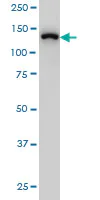 Western blot - Anti-SF3B2 antibody [5D2] (AB56800)