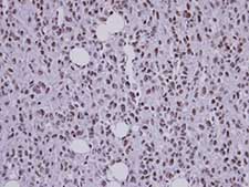Immunohistochemistry (Formalin/PFA-fixed paraffin-embedded sections) - Anti-SF3B3 antibody (AB96683), expandable thumbnail