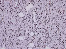 Immunohistochemistry (Formalin/PFA-fixed paraffin-embedded sections) - Anti-SF3B3 antibody (AB96683)