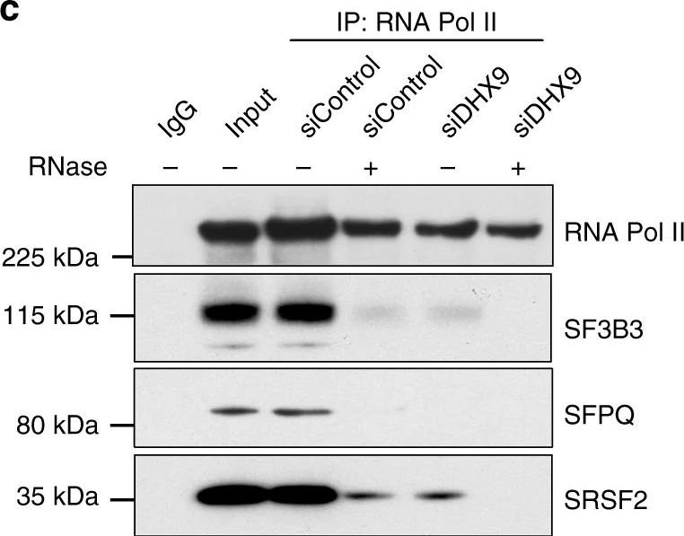 Western blot - Anti-SF3B3 antibody (AB96683)