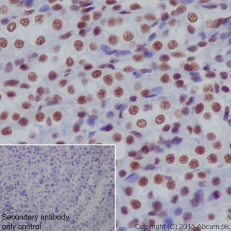 Immunohistochemistry (Formalin/PFA-fixed paraffin-embedded sections) - Anti-SF3B3 antibody [EPR18440] (AB209402)