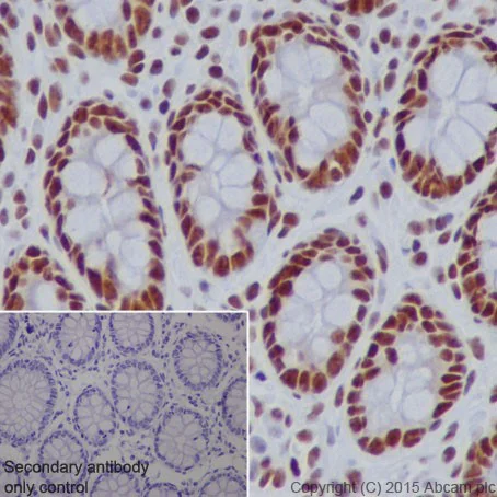 Immunohistochemistry (Formalin/PFA-fixed paraffin-embedded sections) - Anti-SF3B3 antibody [EPR18440] (AB209402)