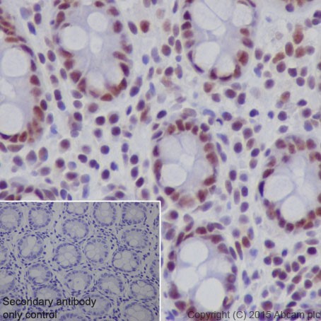 Immunohistochemistry (Formalin/PFA-fixed paraffin-embedded sections) - Anti-SF3B3 antibody [EPR18441] (AB209403)