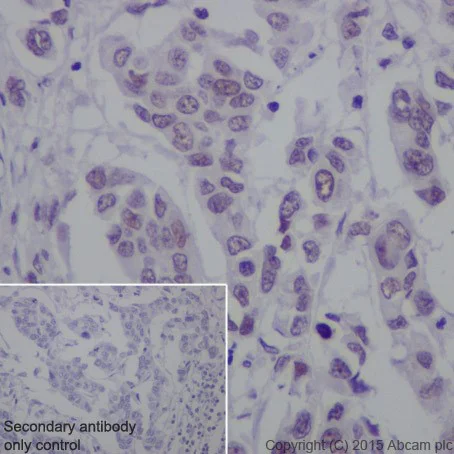 Immunohistochemistry (Formalin/PFA-fixed paraffin-embedded sections) - Anti-SF3B3 antibody [EPR18441] (AB209403)