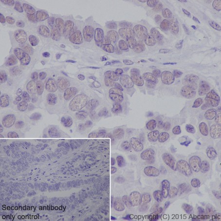Anti-SF3B3 antibody [EPR18441] (ab209403) | Abcam