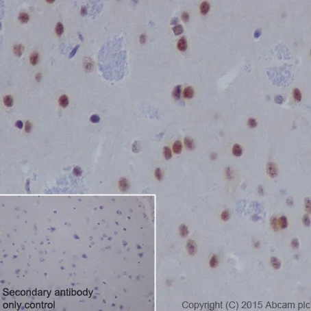 Immunohistochemistry (Formalin/PFA-fixed paraffin-embedded sections) - Anti-SF3B3 antibody [EPR18441] - BSA and Azide free (AB251508)