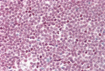 Immunohistochemistry (Formalin/PFA-fixed paraffin-embedded sections) - Anti-SF3B4 antibody [3A1] (AB233565)