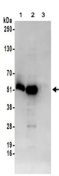Immunoprecipitation - Anti-SF3B4 antibody (AB157117)