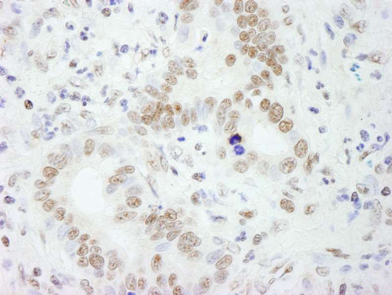 Immunohistochemistry (Formalin/PFA-fixed paraffin-embedded sections) - Anti-SFPQ antibody (AB264196)